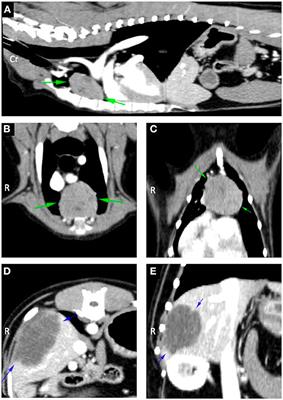 Case report: Immune remission from generalized myasthenia gravis in a dog with a thymoma and cholangiocellular carcinoma